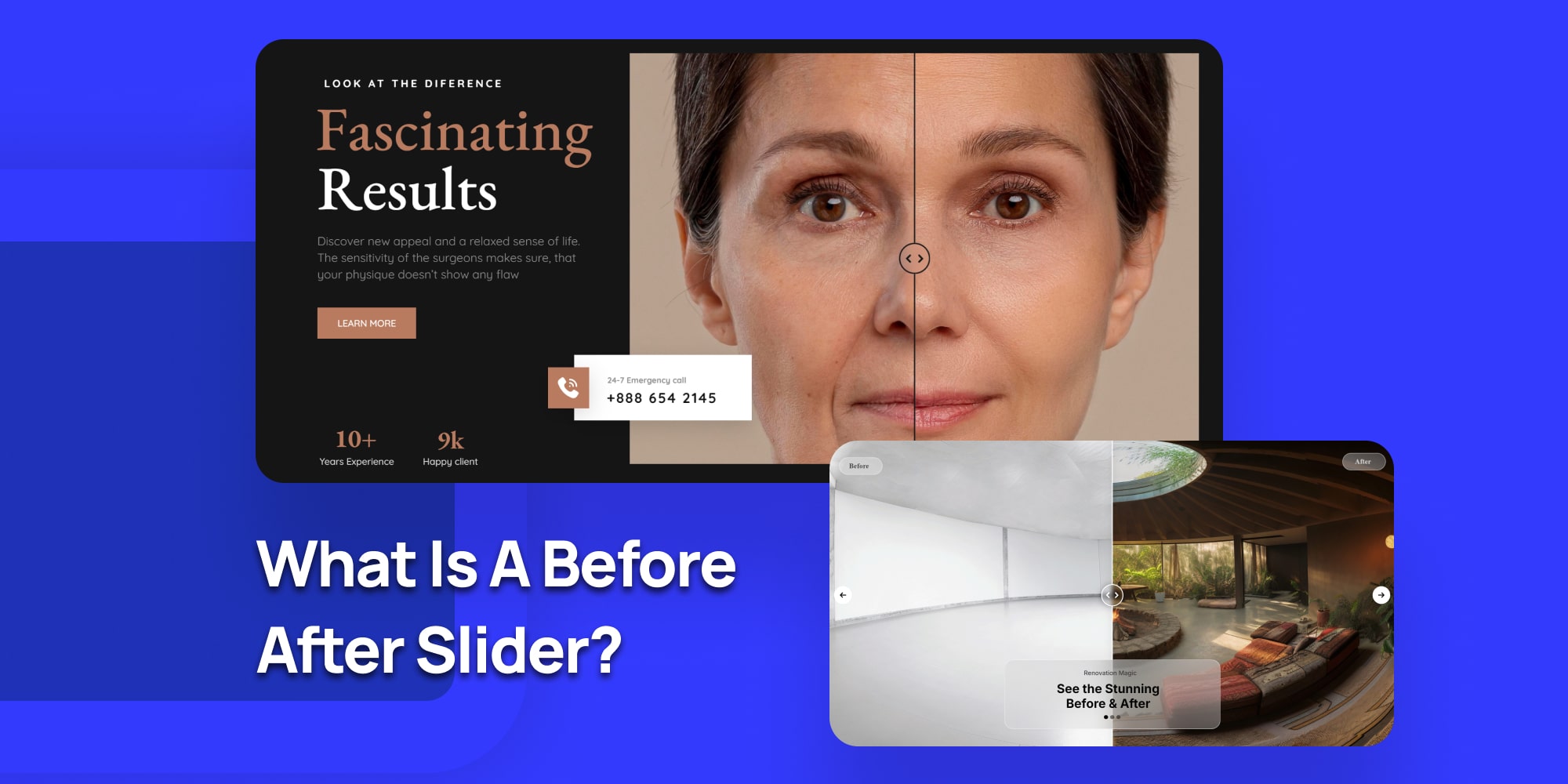 What Is a Before After Slider?